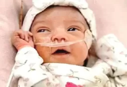 अमेरिका में गर्भ में बच्ची के ब्रेन की सफल सर्जरी, दो घंटे चला ऑपरेशन, 10 डॉक्टरों की टीम ने किया कमाल, जन्म के बाद बच्ची पूरी तरह स्वस्थ